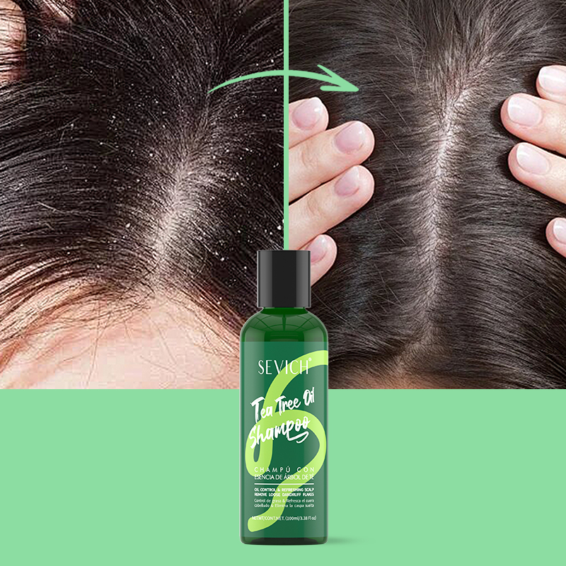 Tea Tree Essence Shampoo Hair  - Hair Care Essence บทวิจารณ์และราคา