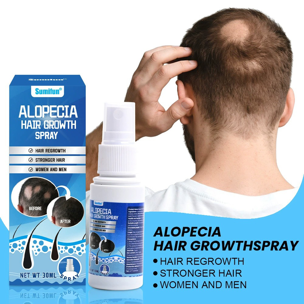 Alopecia Hair Growth Spray Sop - Hair Care Lotion บทวิจารณ์และราคา