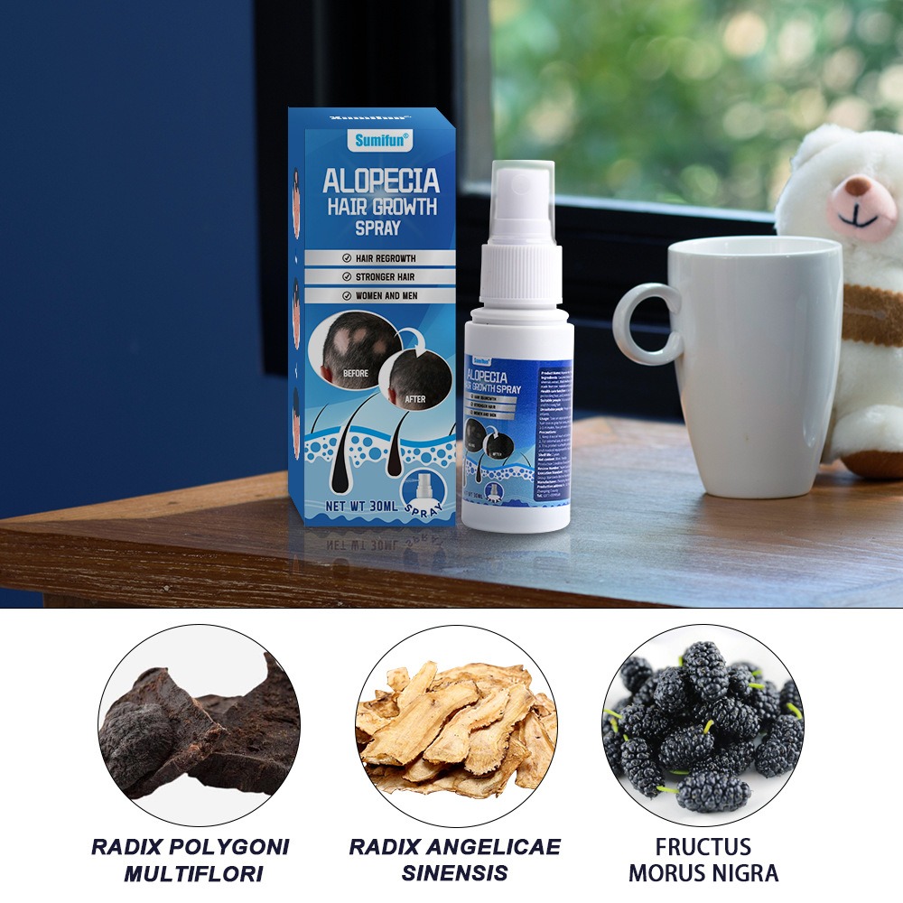 Alopecia Hair Growth Spray Sop - Hair Care Lotion บทวิจารณ์และราคา