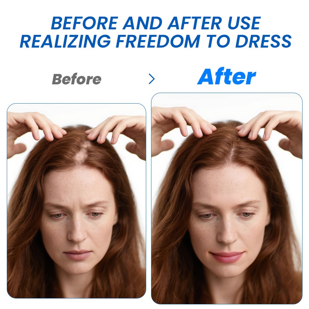 Alopecia Hair Growth Spray Sop - Hair Care Lotion บทวิจารณ์และราคา