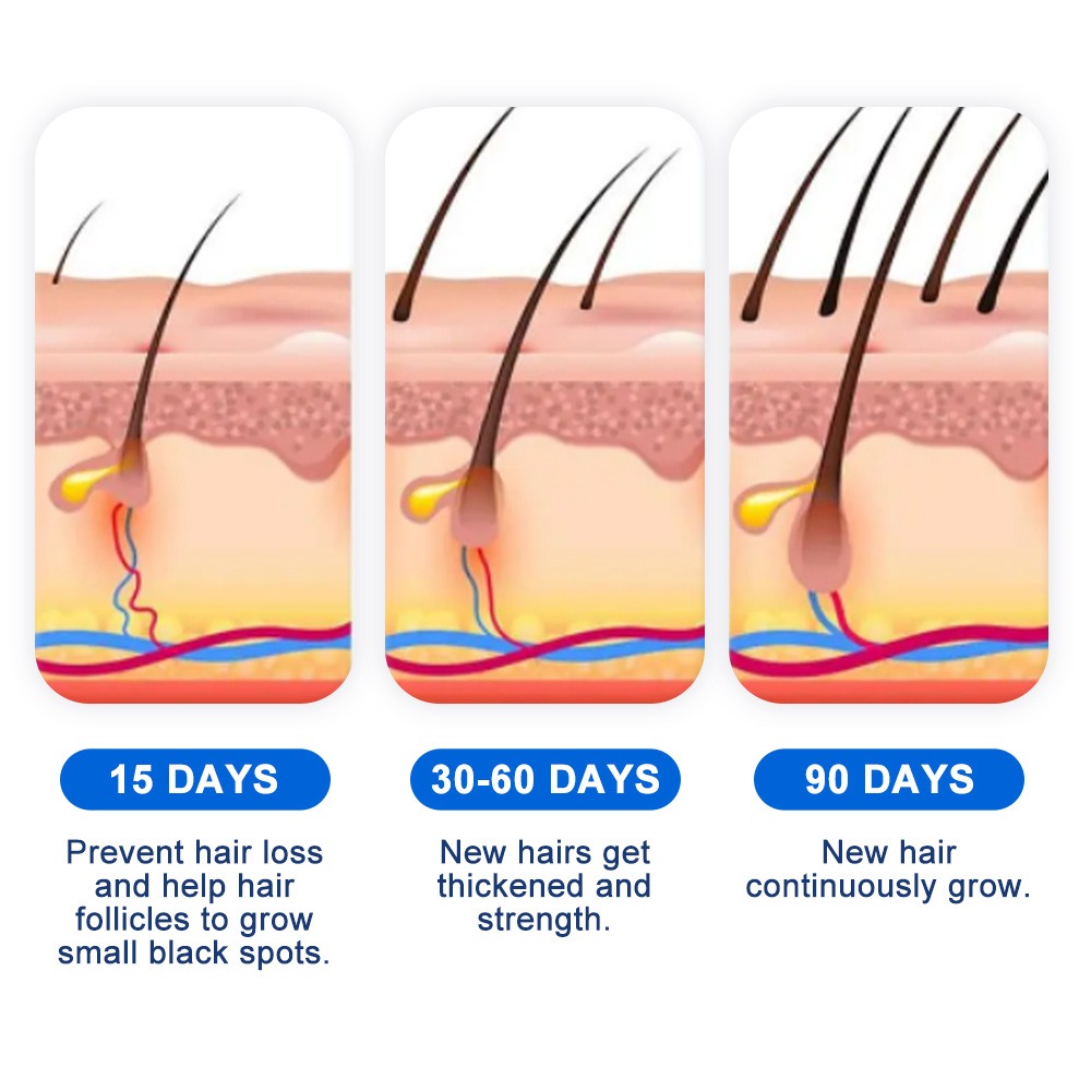 Alopecia Hair Growth Spray Sop - Hair Care Lotion บทวิจารณ์และราคา