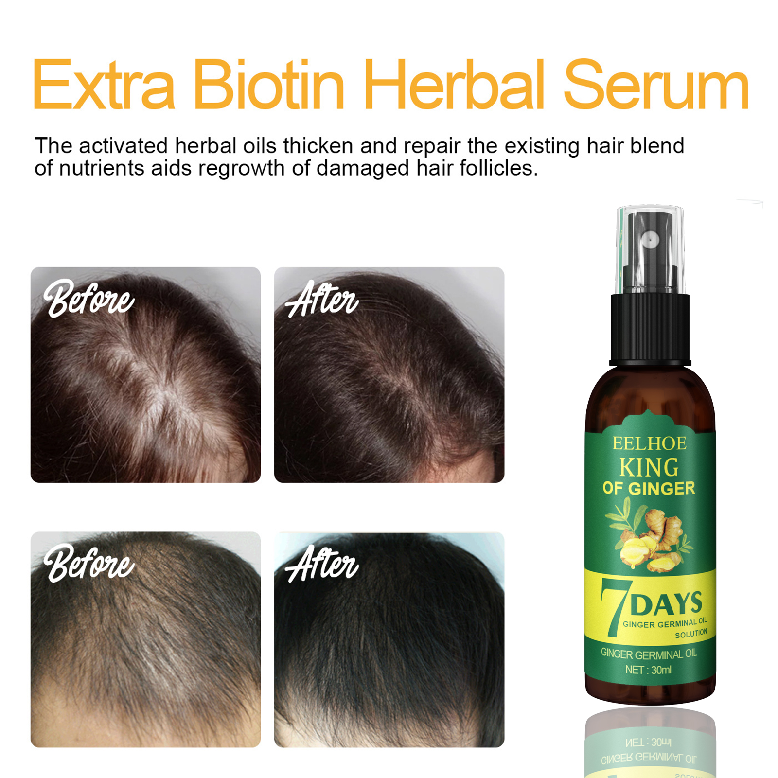Ginger Hair Spray Root Care Se - Hair Care Lotion บทวิจารณ์และราคา