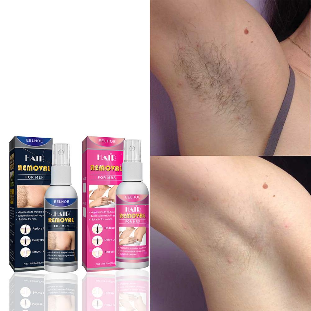 1/2PCS Super Natural Painless  - Hair Care Lotion บทวิจารณ์และราคา