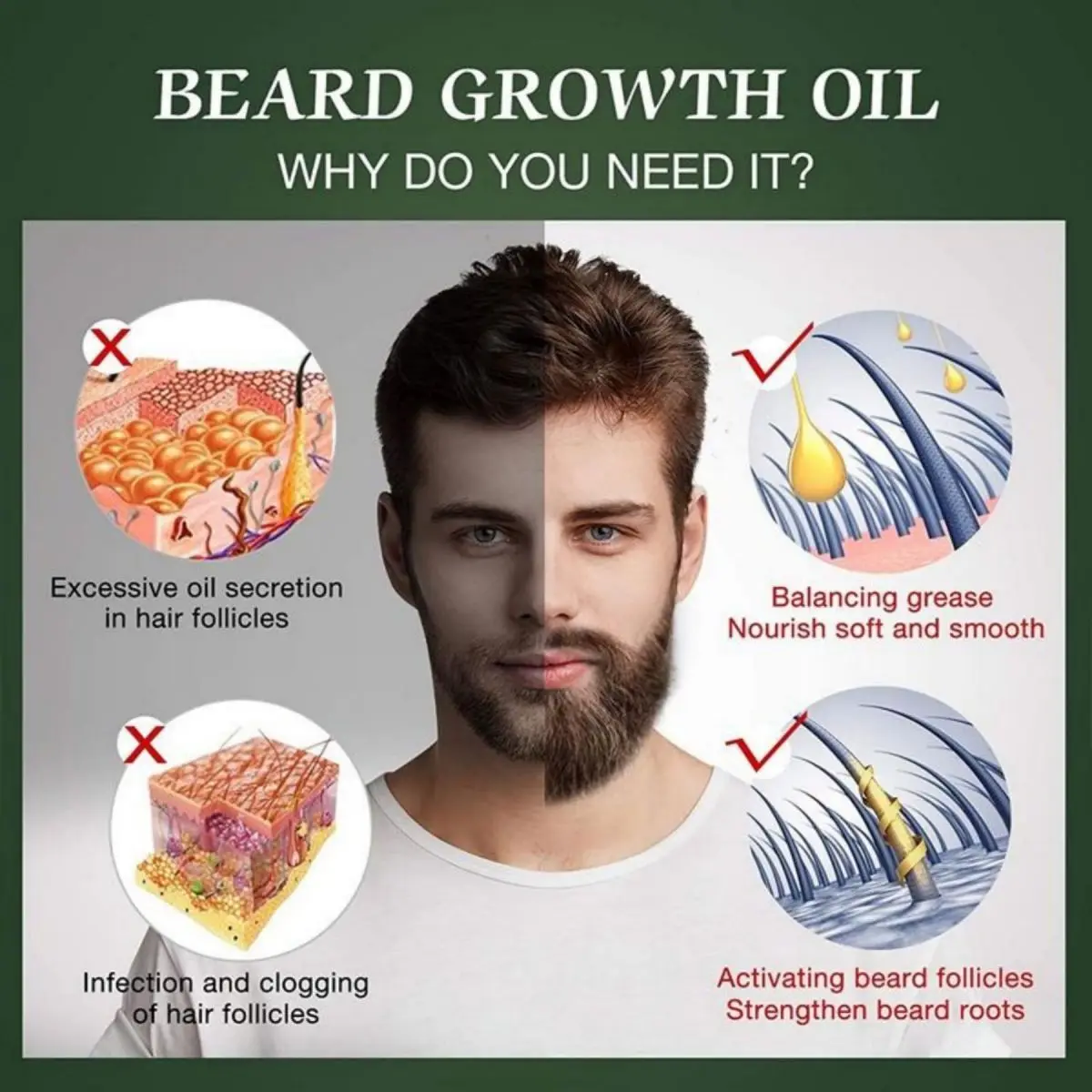 Fast Beard Growth Oil Beard Oi - Hair Care Keratin Shampoo บทวิจารณ์และราคา