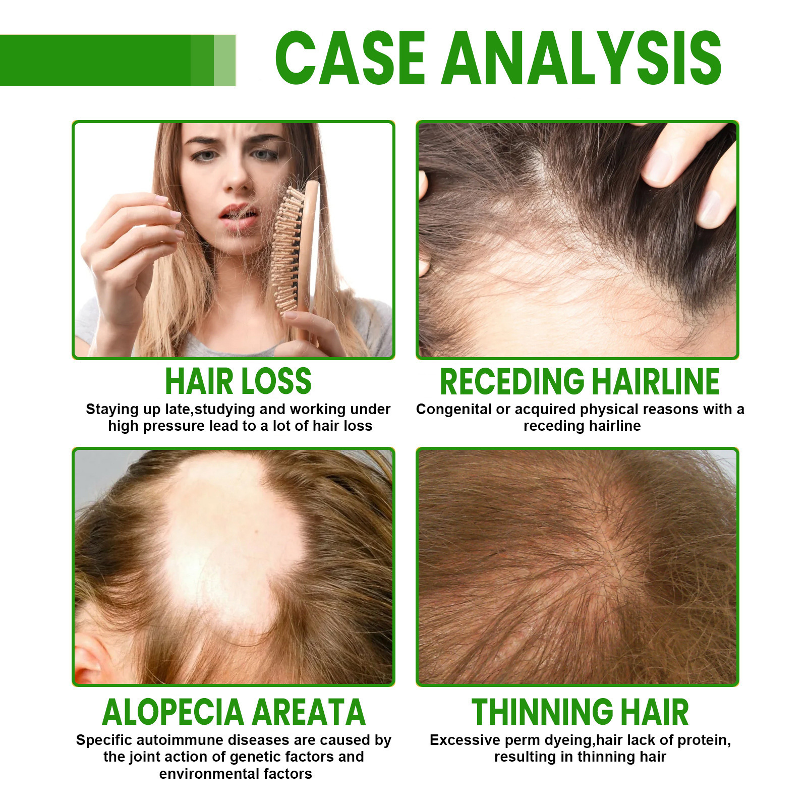 Hair Growth Oil Spray Repair D - Hair Care Essence บทวิจารณ์และราคา