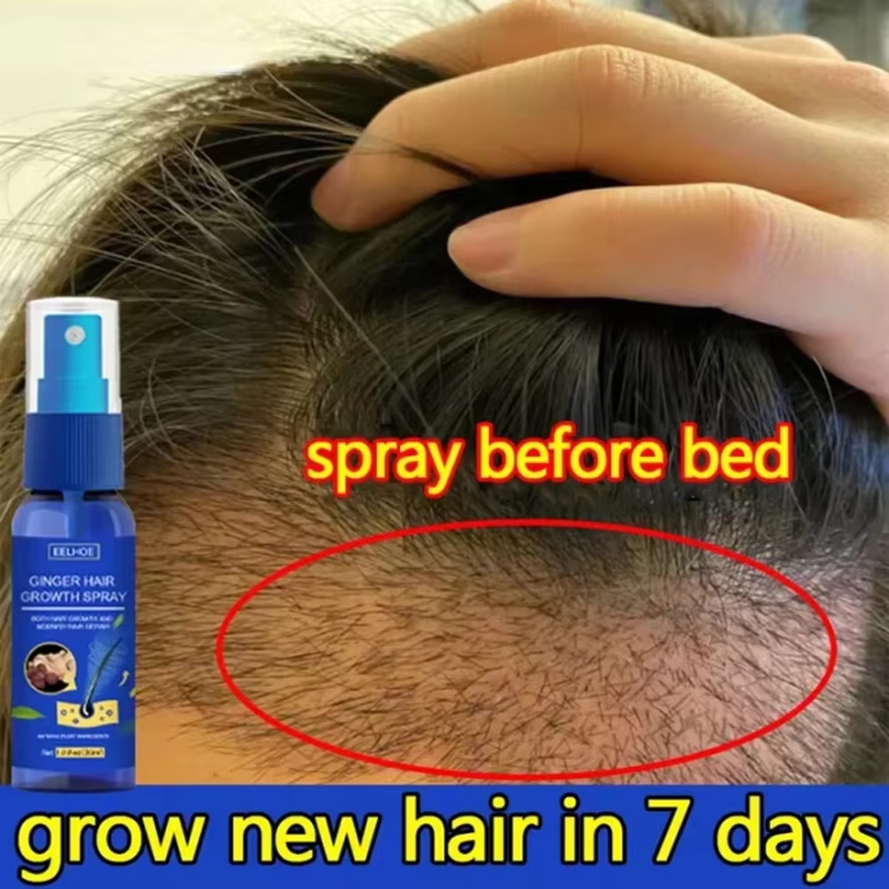 Ginger Hair Growth spray Anti  - Hair Care Essence บทวิจารณ์และราคา