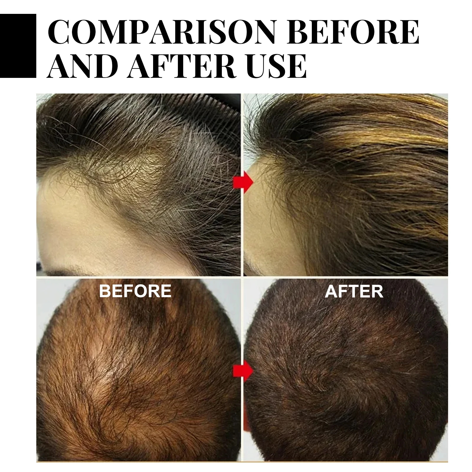 Ginger Hair Growth spray Anti  - Hair Care Essence บทวิจารณ์และราคา