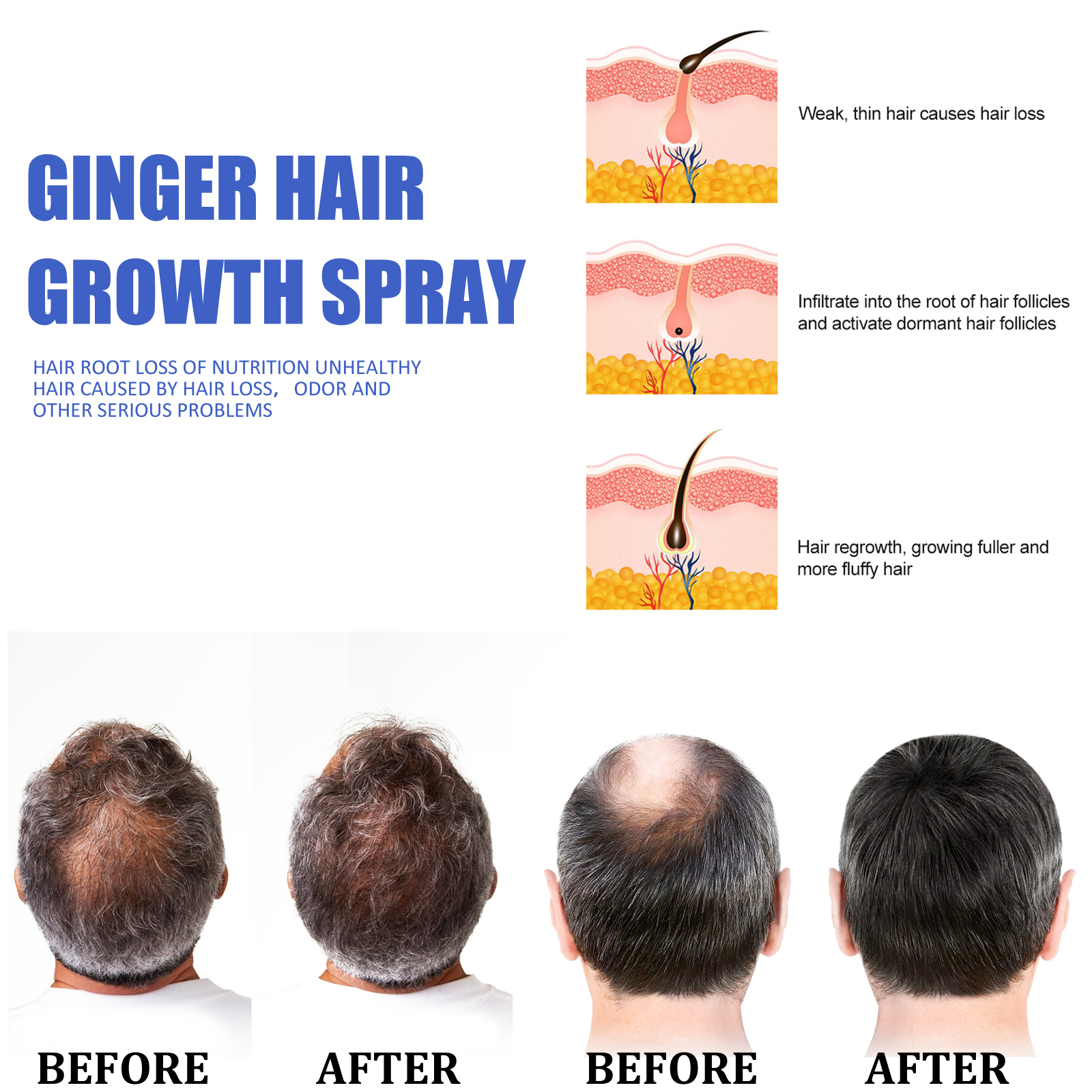 Ginger Hair Growth spray Anti  - Hair Care Essence บทวิจารณ์และราคา